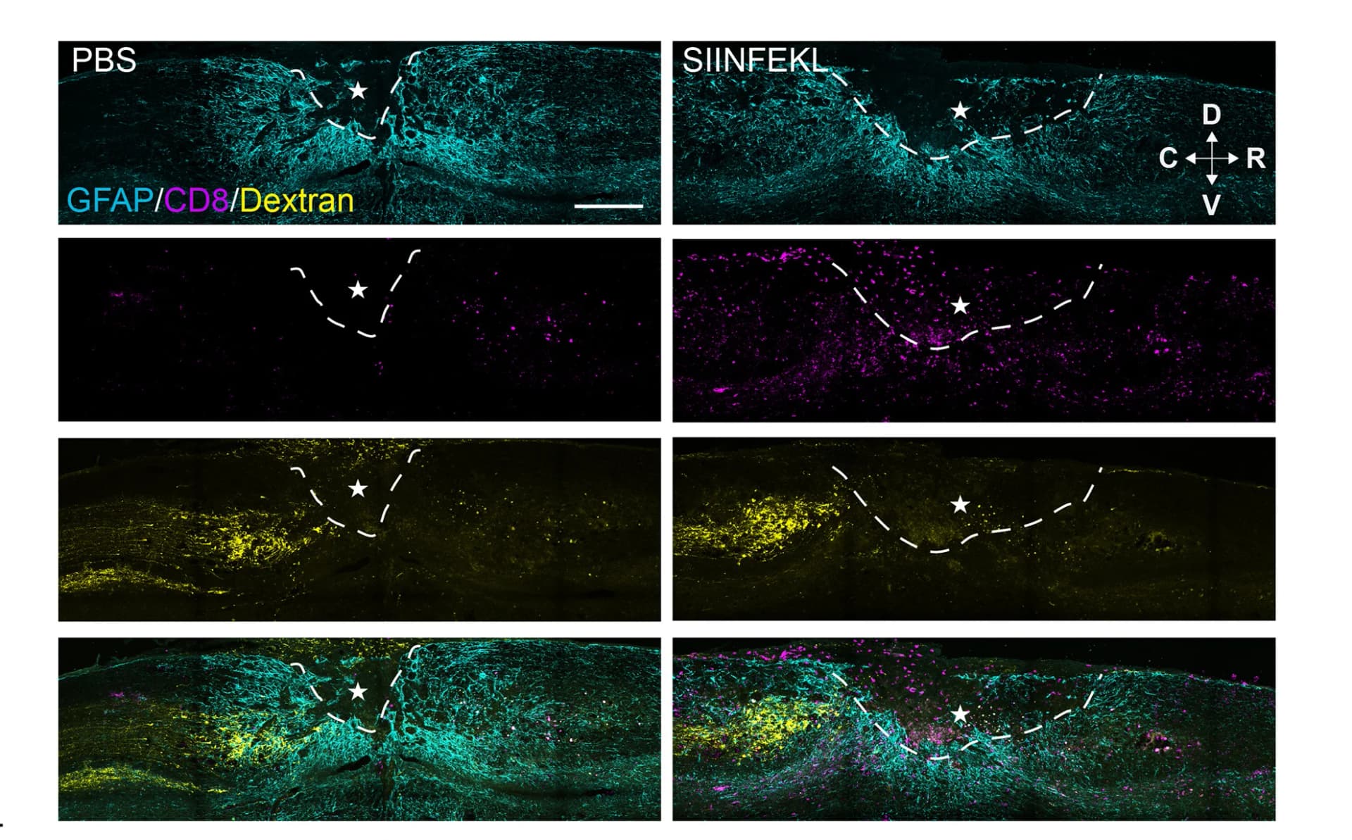 Open access visualization of Microscopy, Spinal Cord, Dextran-Labeled Axons, GFAP, CD8