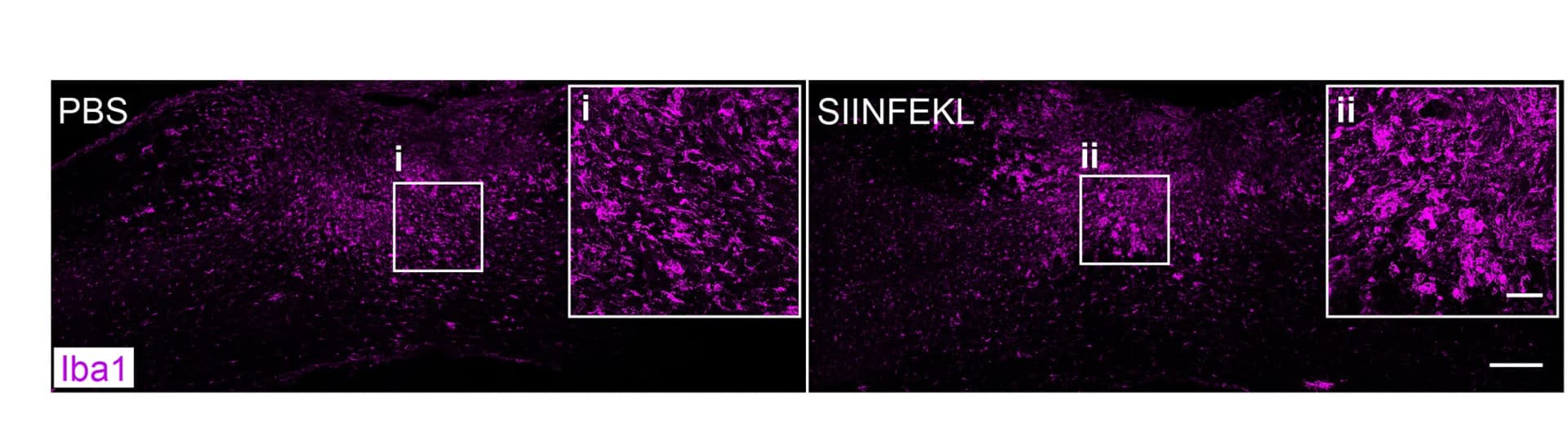 Open access visualization of Microscopy, Iba1, Spinal Cord Lesion, Immunostaining