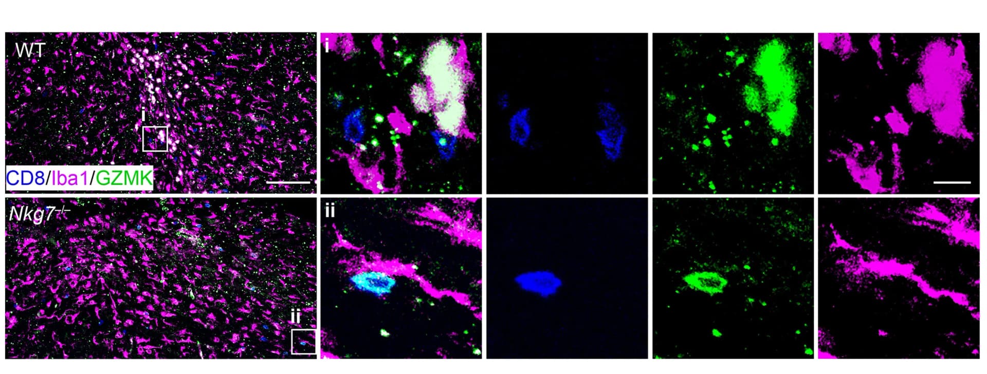 Open access visualization of Microscopy, Immunostaining, Lesion Site, Spinal Cord, CD8