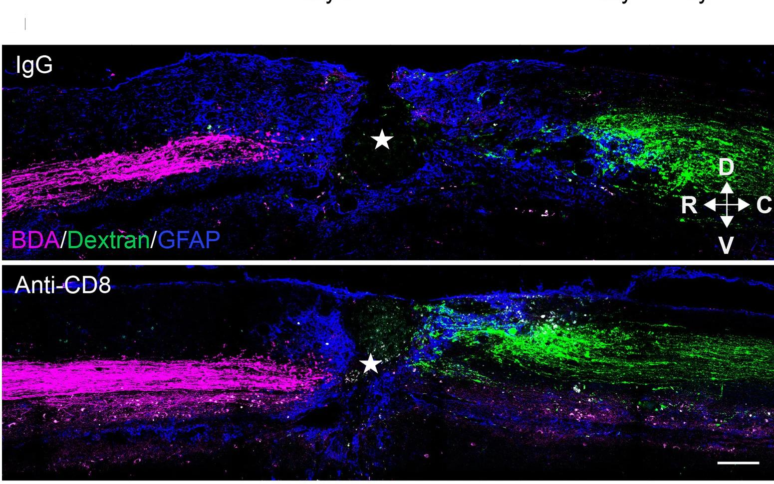 Open access visualization of Microscopy, Spinal Cord, Sagittal Sections, Dextran-labeled DC Axons, CST
