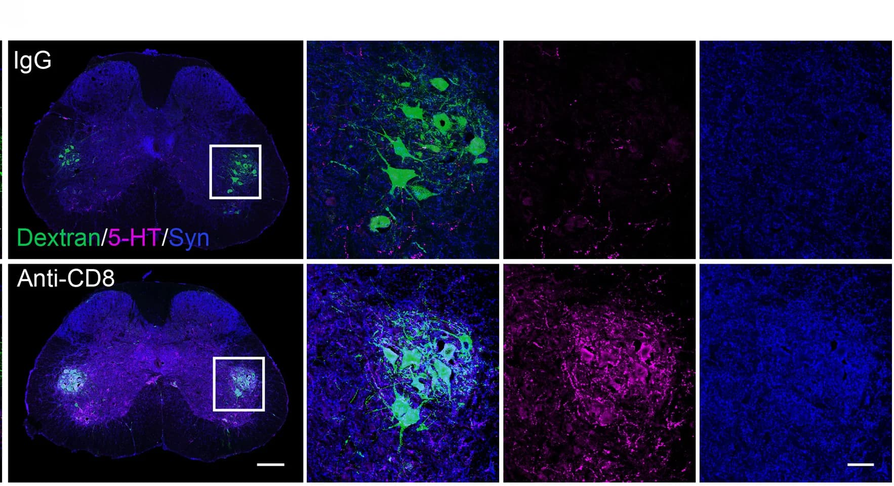 Open access visualization of Microscopy, 5-HT, Axons, Motor Neurons, Dextran