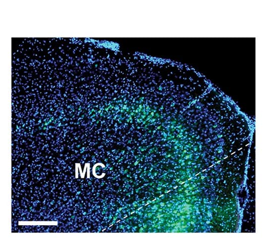 Open access visualization of Microscopy, GCaMP8s, Cortico-striatal Projections, Motor Cortex
