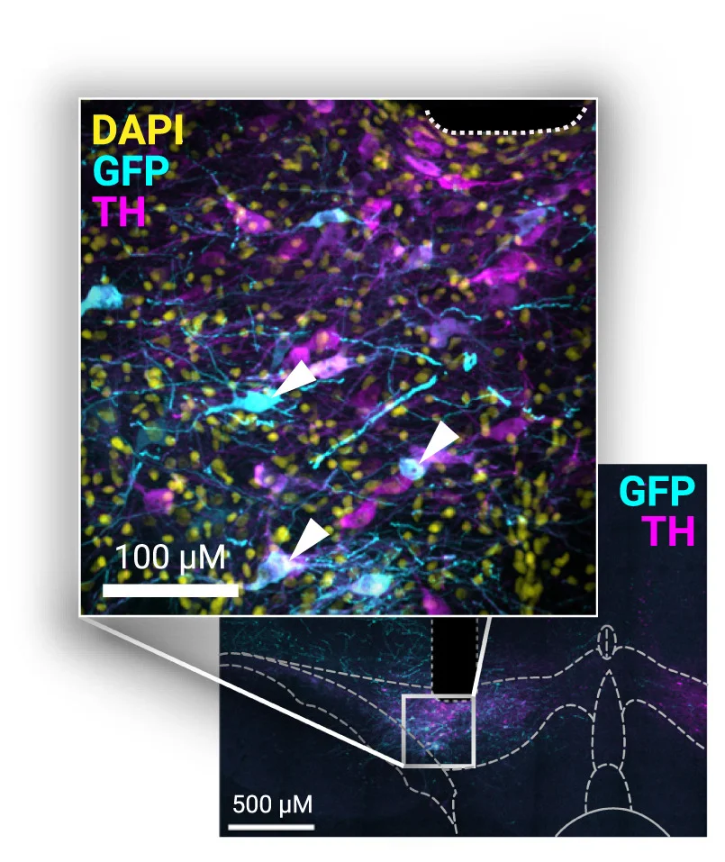 Open access visualization of Microscopy, Fiber Placement, jGCaMP7c, GFP Expression, TH