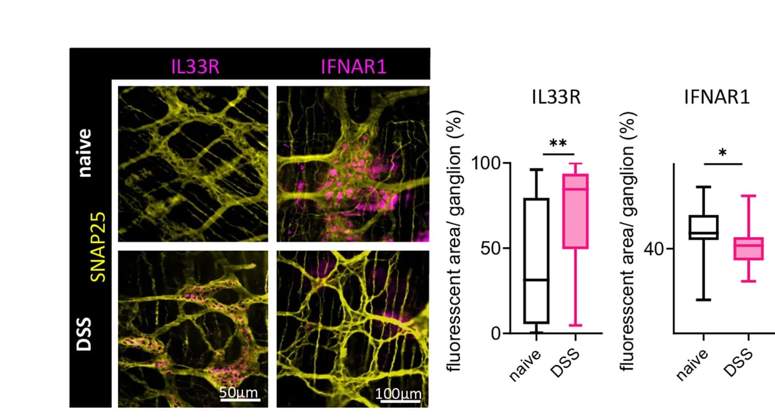 Open access visualization of Microscopy, Box Plot, Immunofluorescence Staining, Colonic Muscularis, Interleukin-33R
