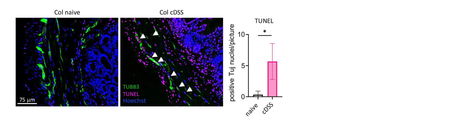 Open access visualization of Microscopy, Bar Plot, Error Bars, Immunofluorescence Staining, Colonic Sections