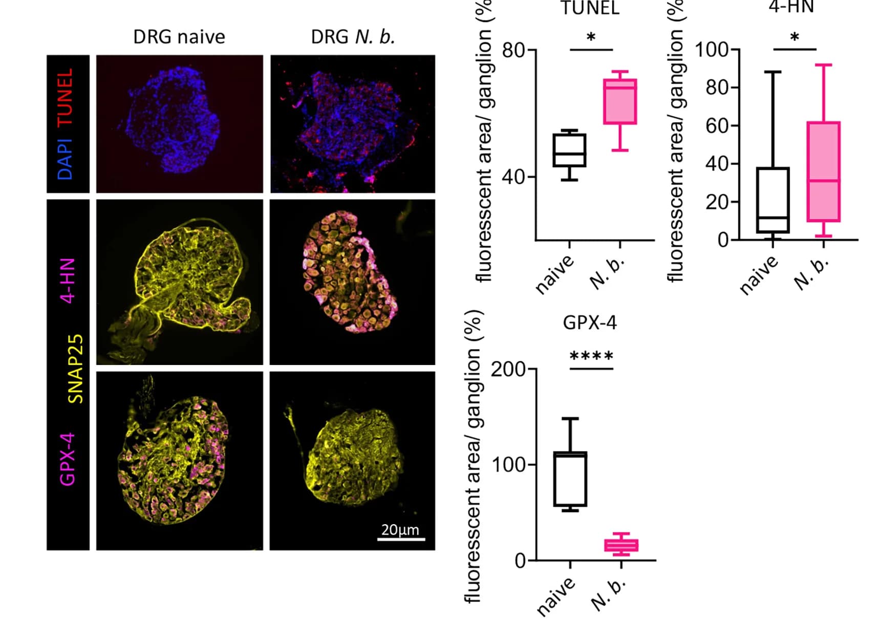 Open access visualization of Microscopy, Box Plot, Photo, Immunofluorescence Staining, Murine DRGs