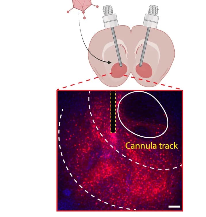 Open access visualization of Microscopy, Illustration, Brain Coronal Section, AAV10-ESYNDIO-HaloTagTM2A-dTomato Transduction, Cannula Implantation