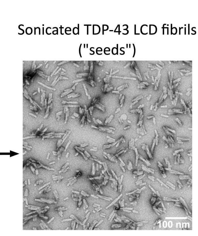 Open access visualization of Microscopy, Electron Micrograph, Sonicated TDP-43 LCD Fibrils