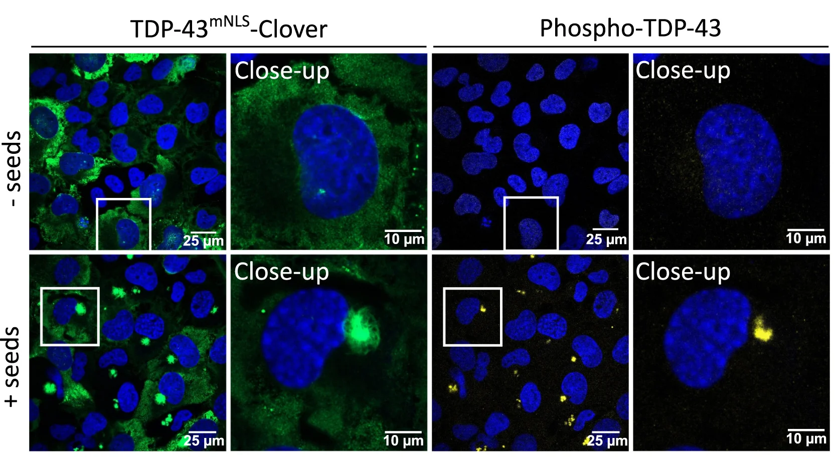 Open access visualization of Microscopy, Immunostaining, TDP-43mNLS-Clover, Phospho-TDP-43, DAPI