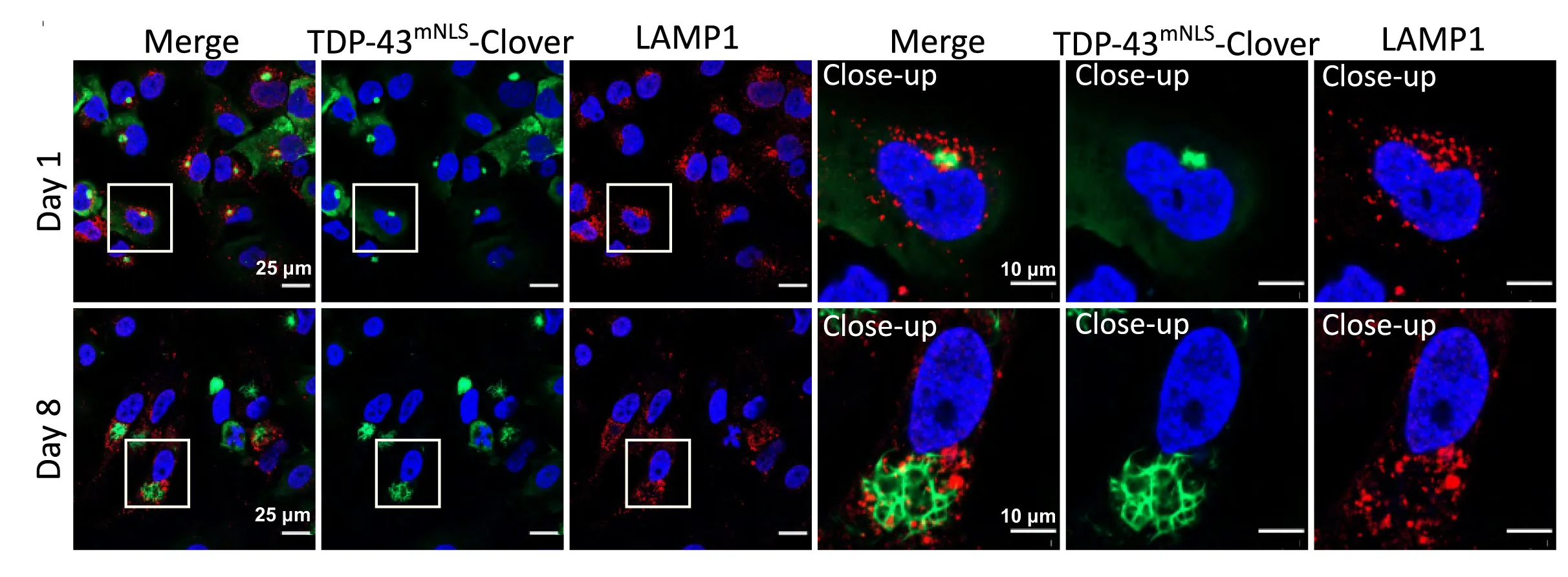 Open access visualization of Microscopy, Immunostaining, Lysosomal Marker, LAMP1, TDP-43mNLS-Clover