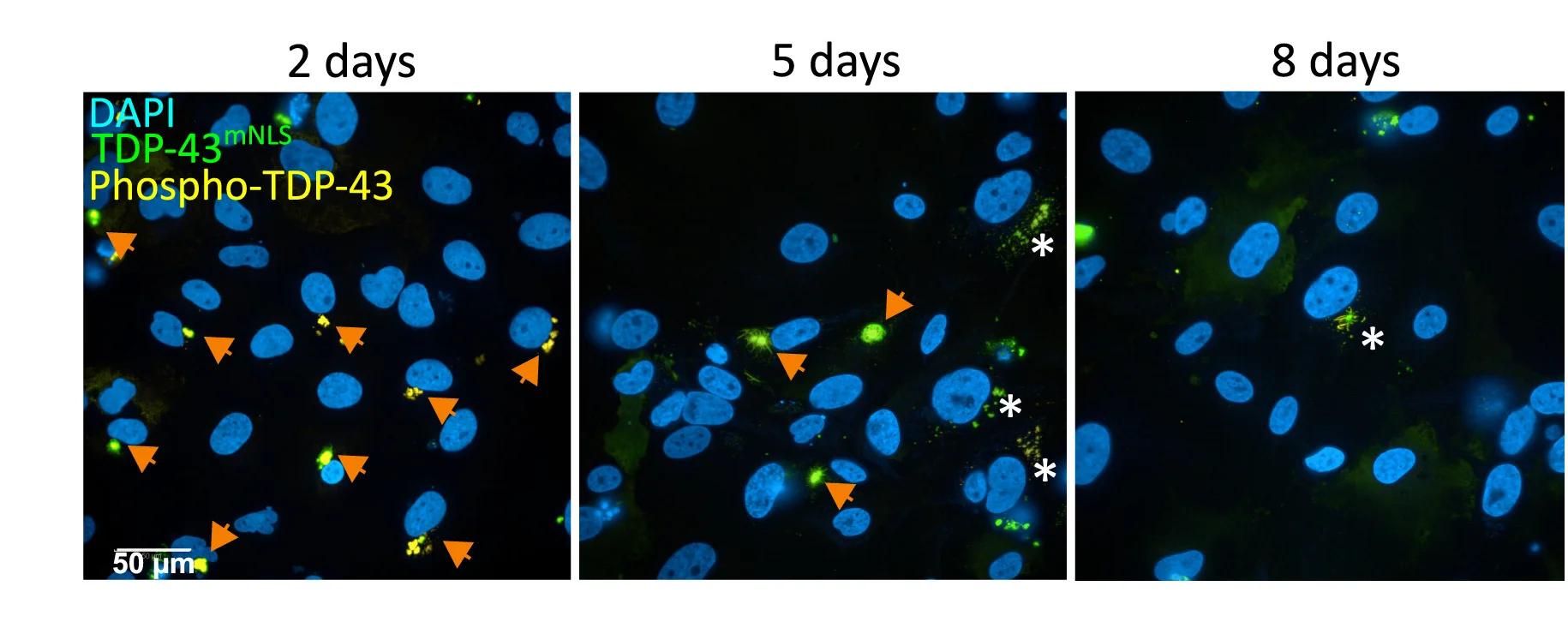 Open access visualization of Microscopy, Immunostaining, TDP-43mNLS-Clover, Phospho-TDP-43, DAPI