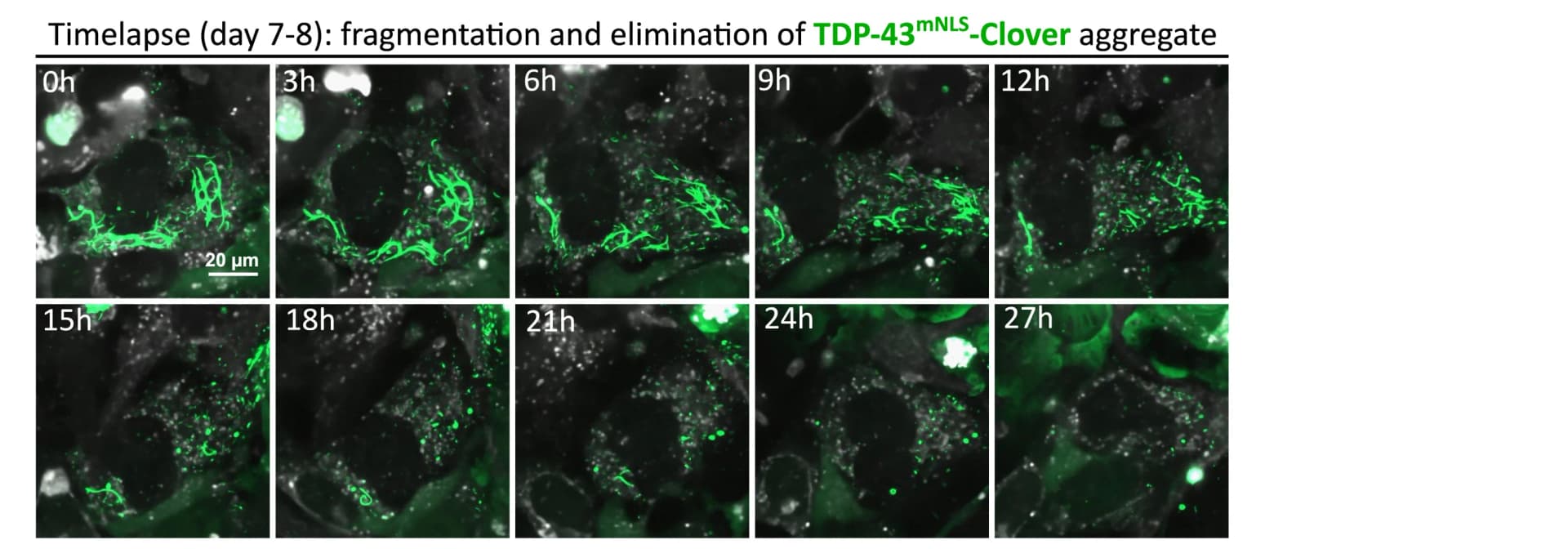 Open access visualization of Microscopy, Time-Lapse Imaging, TDP-43mNLS-Clover Aggregates, Seeds