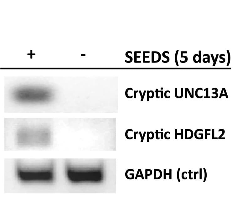 Open access visualization of Gel, RT-PCR, De Novo Cryptic RNA Transcripts, UNC13A, HDGFL2