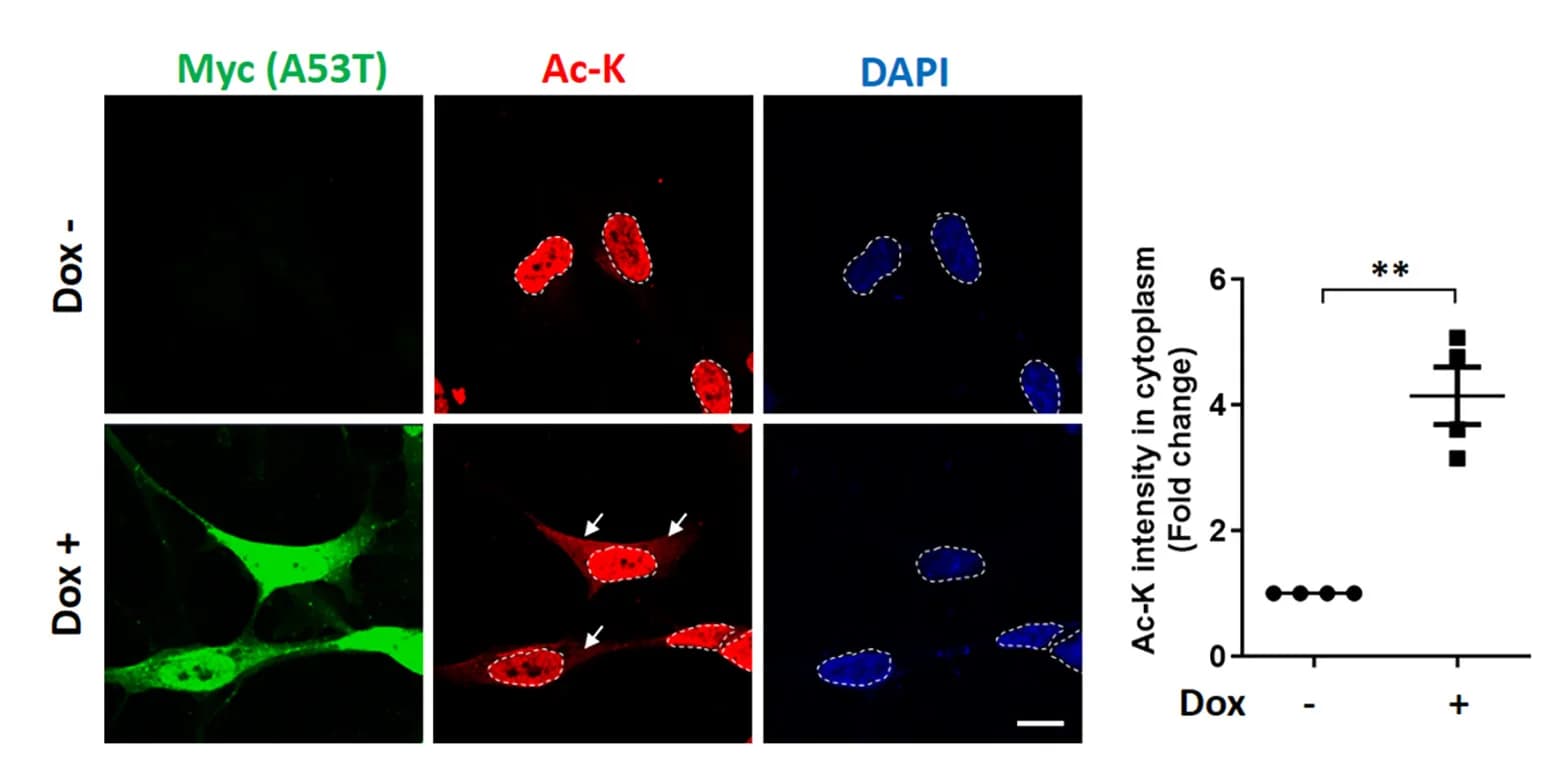 Open access visualization of Microscopy, Scatter Plot, Acetyl-Lysine, Cytoplasm, A53T alpha-Syn