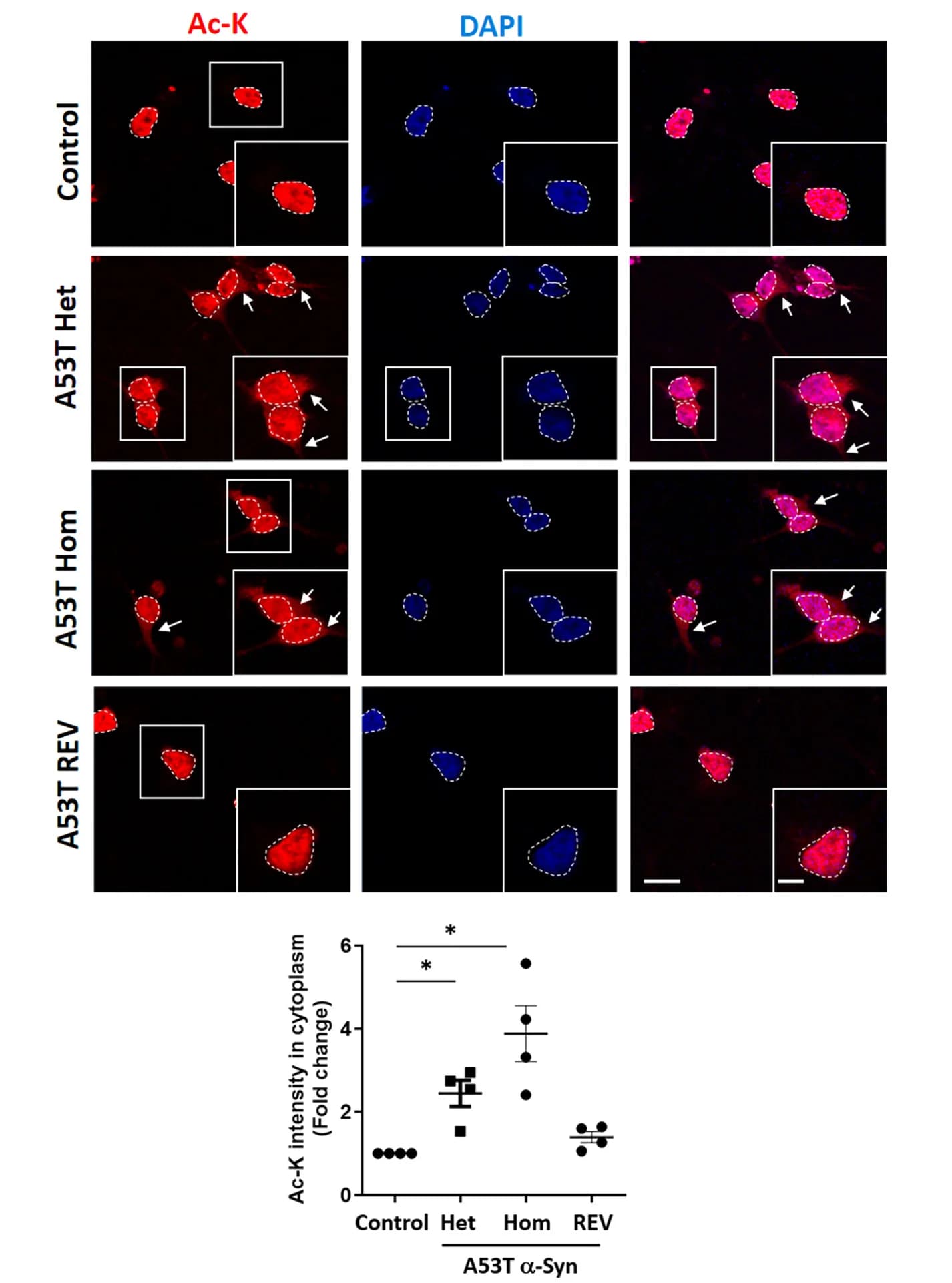 Open access visualization of Microscopy, Scatter Plot, Error Bars, Acetylation, Cytoplasm