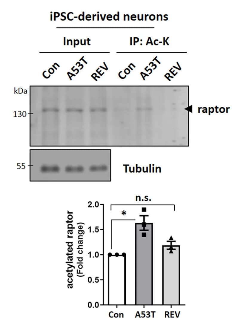 Open access visualization of Bar Plot, Error Bars, Gel, Photo, Acetylation of Raptor