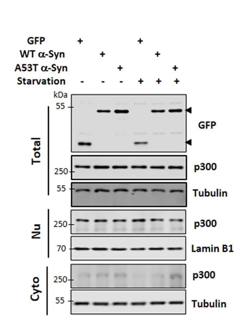 Open access visualization of Gel, Nuclear Translocation of p300, SH-SY5Y Cells, GFP-tagged WT alpha-Syn, GFP-tagged A53T alpha-Syn