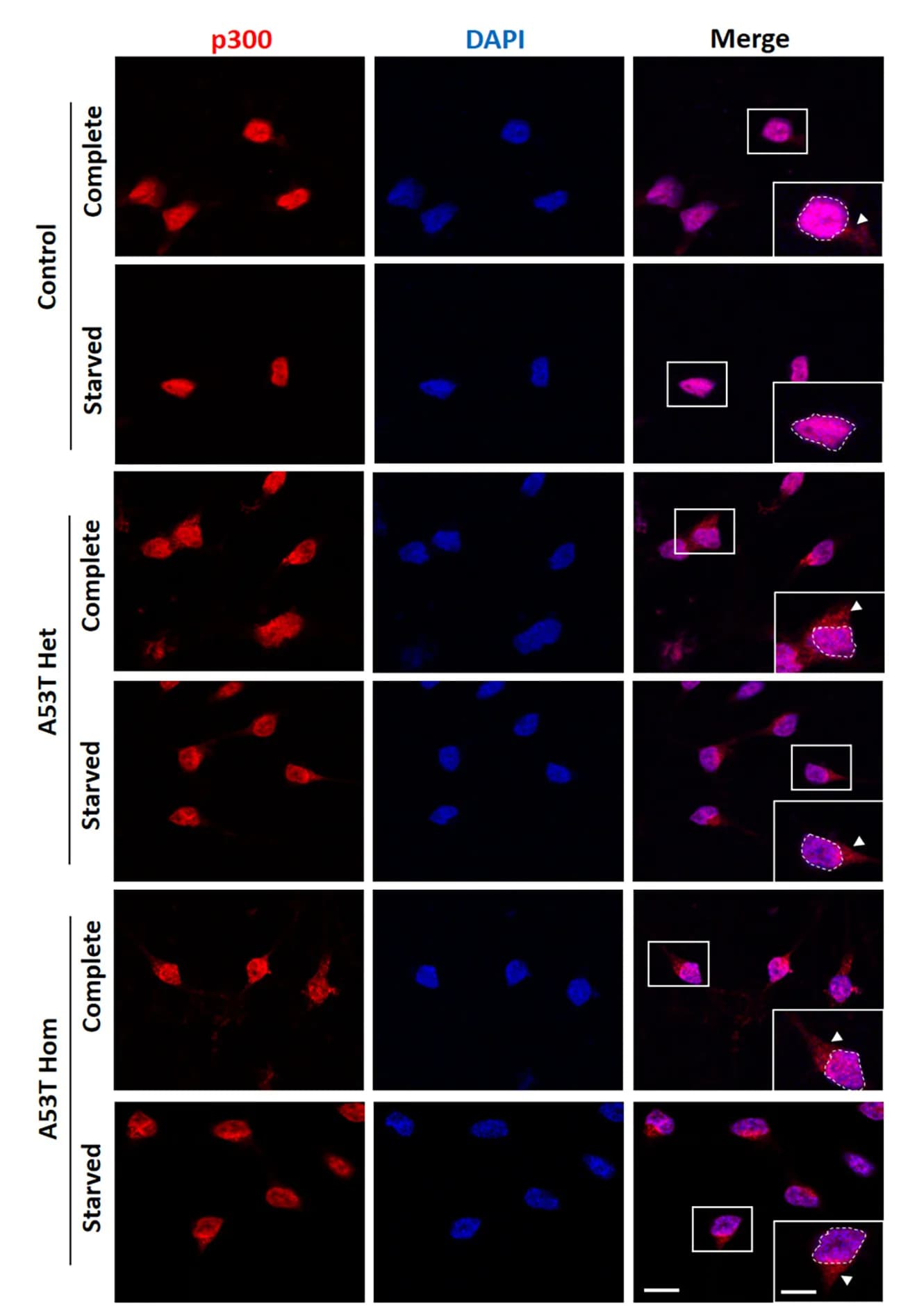 Open access visualization of Microscopy, p300 Localization, Control iPSC-derived Neurons, A53T alpha-Syn iPSC-derived Neurons, Starved Neurons