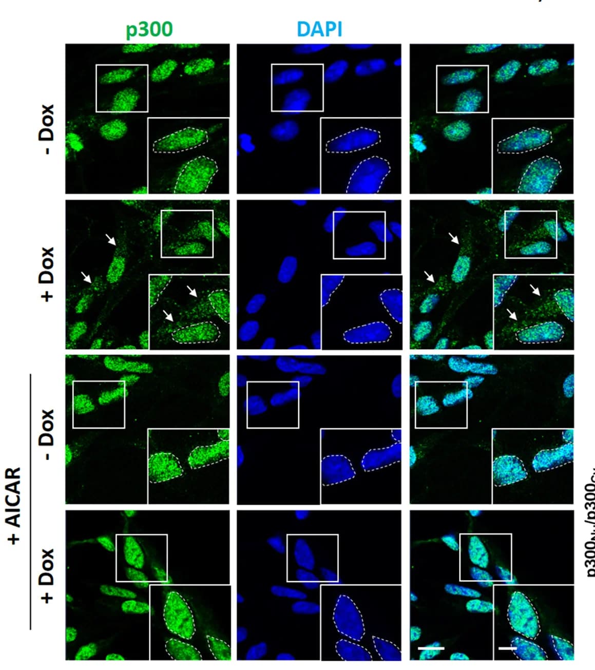 Open access visualization of Microscopy, p300 Localization, A53T alpha-Syn, SH-SY5Y Cells, Dox