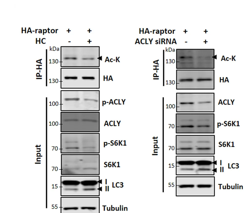 Open access visualization of Gel, Raptor Acetylation, ACLY inhibition, HC treatment, siRNA transfection