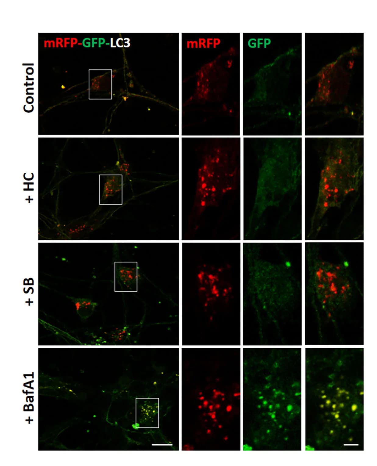 Open access visualization of Microscopy, Autophagic Flux, Mouse Primary Cortical Neurons, mRFP-GFP-LC3 (tfLC3), Autophagosomes