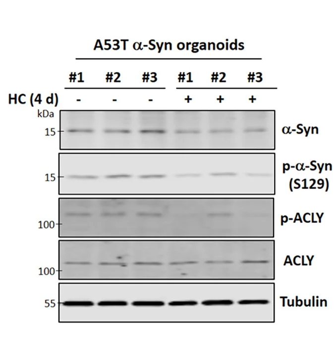 Open access visualization of Gel, alpha-Syn Levels, A53T alpha-Syn, Midbrain Organoids, HC Treatment