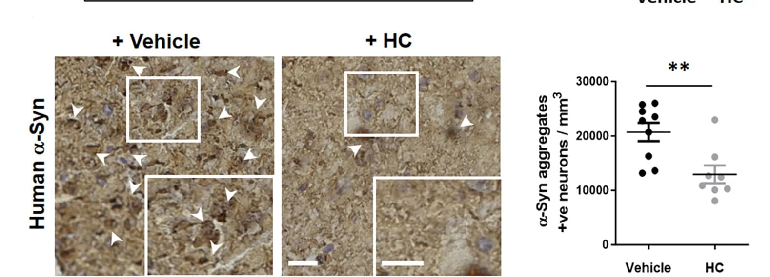 Open access visualization of Microscopy, Scatter Plot, Error Bars, Human alpha-Synuclein, SNCA Mice