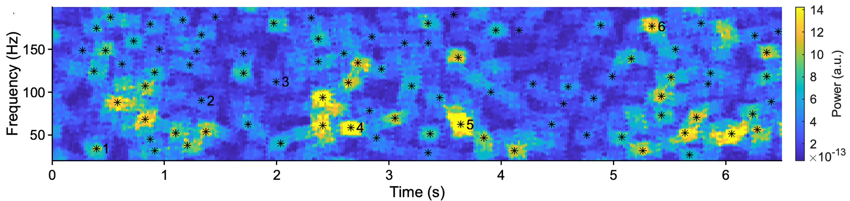 Open access visualization of Heatmap, Spectrogram, Burst Detection, LFP, Oscillatory Bursts