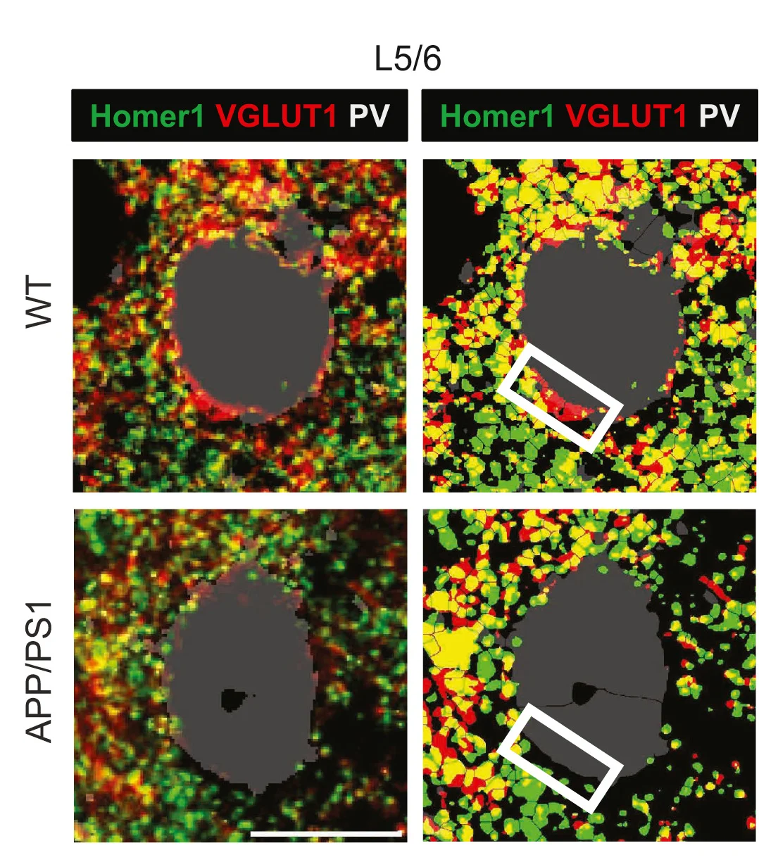 Open access visualization of Microscopy, Confocal Images, PV Interneurons, Homer1, VGLUT1
