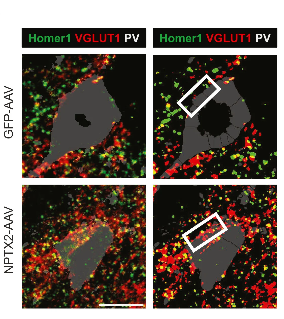 Open access visualization of Microscopy, Confocal Images, PV Interneurons, Homer1, VGLUT1