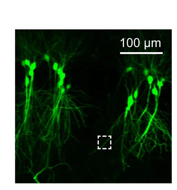 Open access visualization of Microscopy, Transverse Imaging, CA1, Microperiscope, Thy1-GFP-M Mouse
