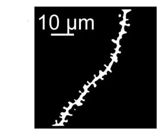 Open access visualization of Microscopy, Dendrite, Binarized Image, Dendritic Spines