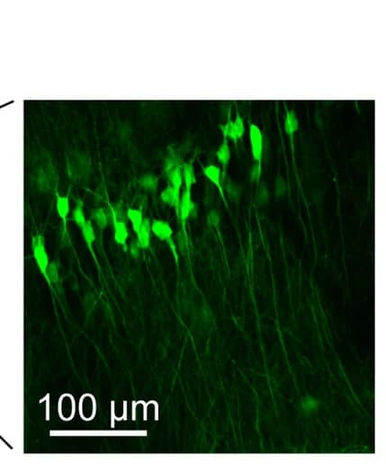 Open access visualization of Microscopy, GCaMP6s, Somatodendritic Axis, CA1 Neurons, Microperiscope