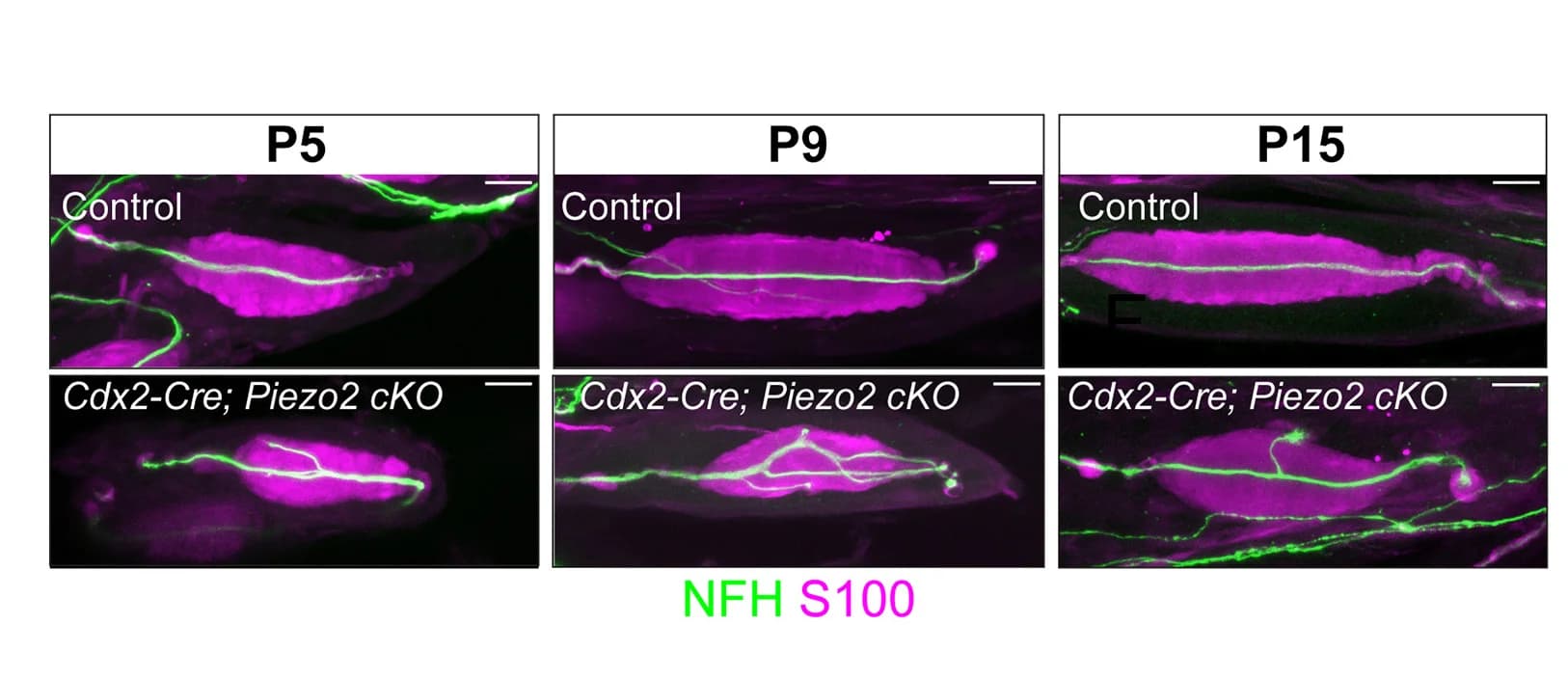 Open access visualization of Microscopy, Pacinian Corpuscles, Postnatal Days, Anti-NFH, Anti-S100