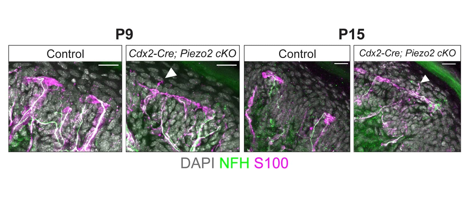 Open access visualization of Microscopy, Meissner Corpuscles, DAPI, Anti-NFH, Anti-S100