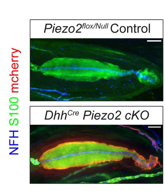 Open access visualization of Microscopy, Pacinian Corpuscles, NFH, S100, mCherry