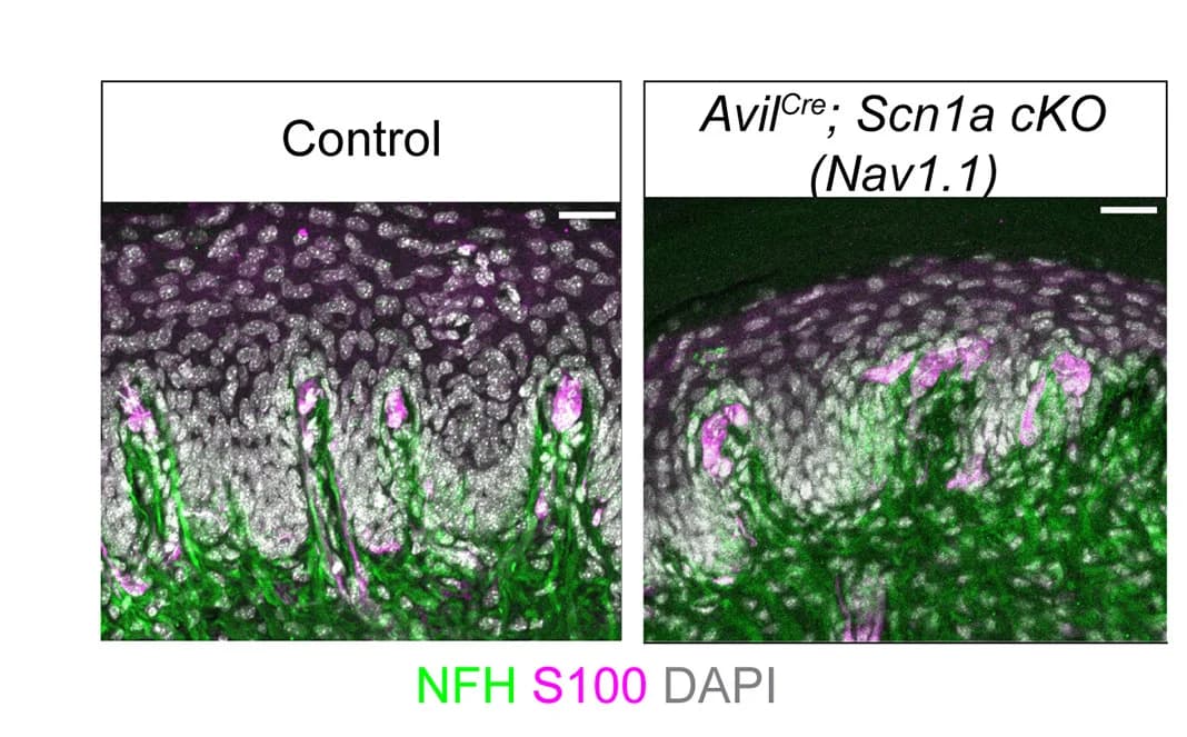 Open access visualization of Microscopy, Meissner Corpuscles, Immunostaining