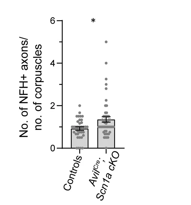 Open access visualization of Bar Plot, Error Bars, Scatter Plot, NFH+ Axons, Meissner Corpuscles