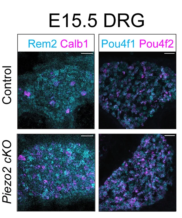 Open access visualization of Microscopy, DRG, Control, Cdx2-Cre, Piezo2 cKO