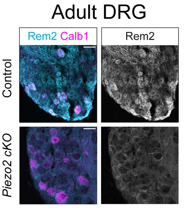 Open access visualization of Microscopy, Lumbar-Level Adult DRG, RNAScope Probes, Calb1, Rem2