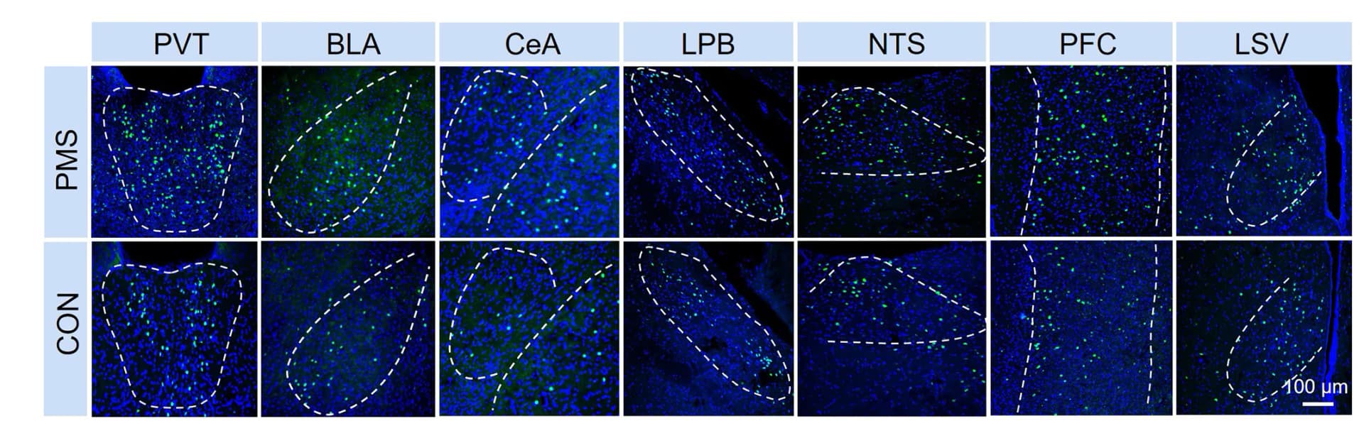 Open access visualization of Microscopy, c-Fos Expression, Brain Regions, Mice, CRD Stimulation