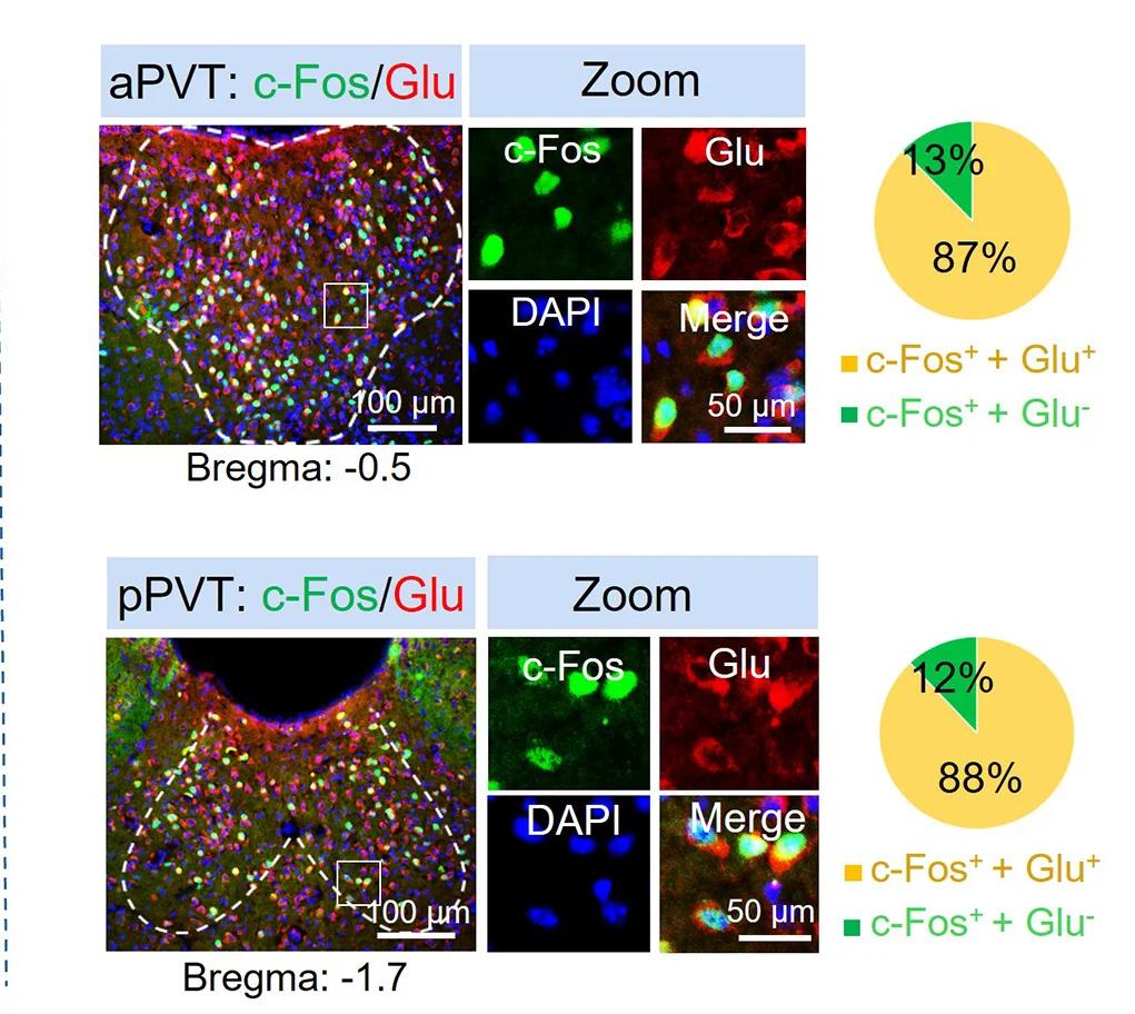Open access visualization of Microscopy, Pie Chart, Images, c-Fos, Glu