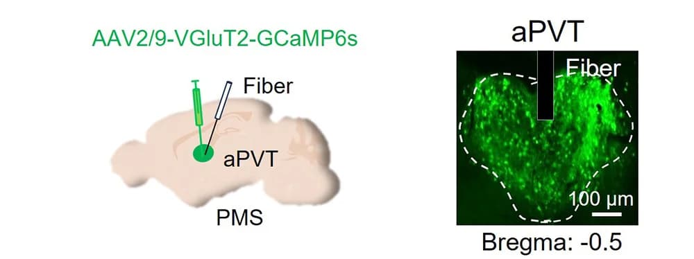 Open access visualization of Microscopy, Illustration, Schematic, Calcium Indicator, Virus Injection