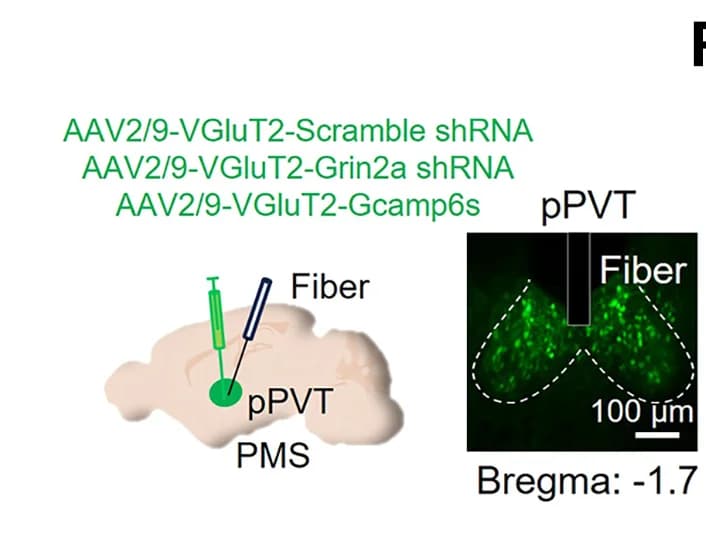 Open access visualization of Microscopy, Illustration, Viral Strategy, Fluorescence Images, Grin2a Knockdown