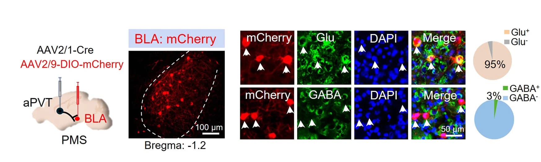 Open access visualization of Microscopy, Pie Chart, Neuron Types, aPVT, BLA
