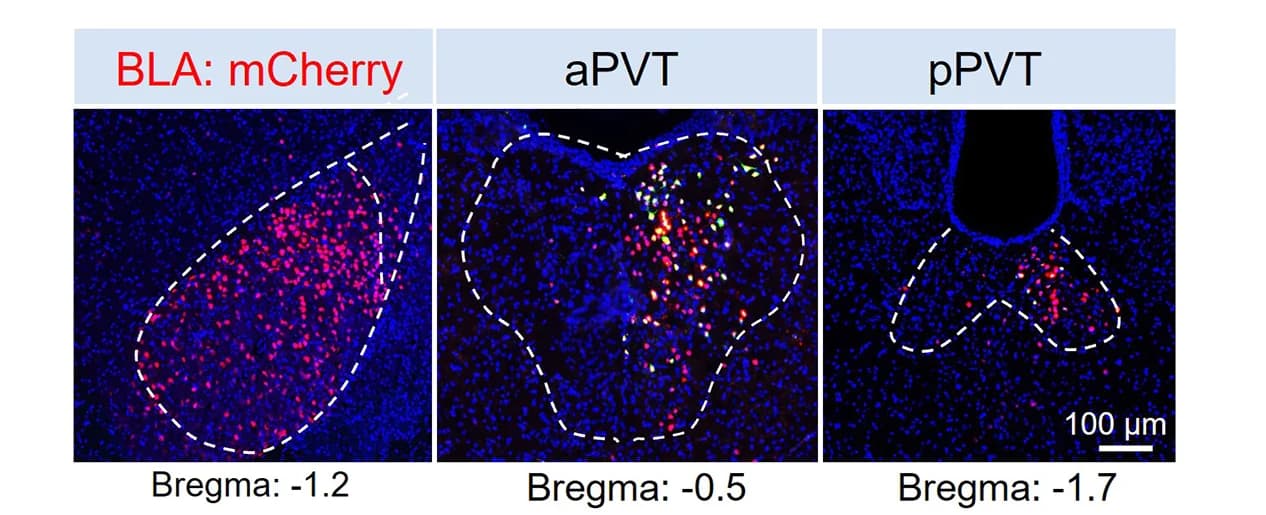 Open access visualization of Microscopy, Retrograde Tracing, BLA, CRD, aPVT Neurons