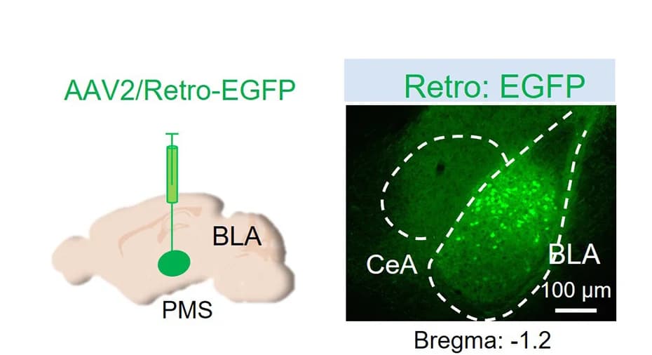 Open access visualization of Microscopy, Illustration, Retrograde Tracer, Virus Injection, BLA