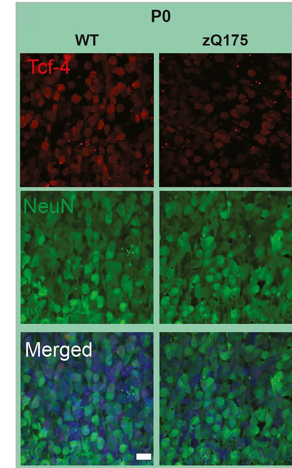 Open access visualization of Microscopy, Tcf4 Protein Expression, zQ175, WT, CTX