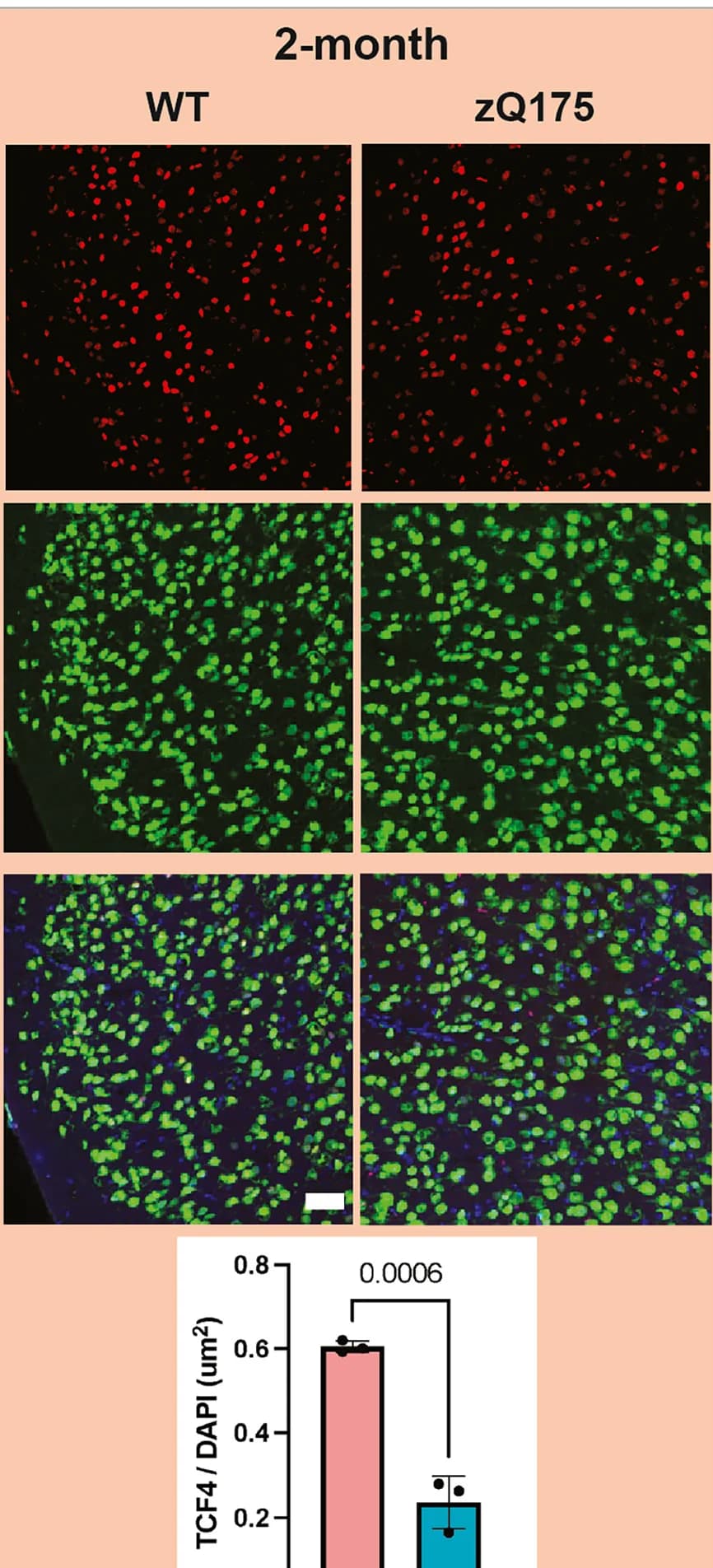 Open access visualization of Microscopy, Bar Plot, Error Bars, Tcf4 Protein Expression, zQ175