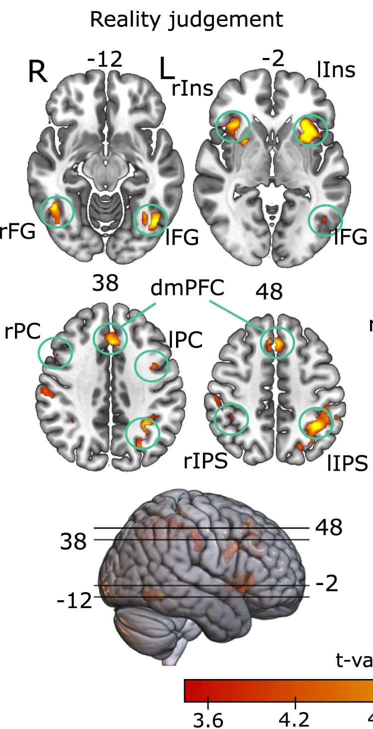 Open access visualization of 3D Plot, Brain Areas, Reality Judgment, Modulation